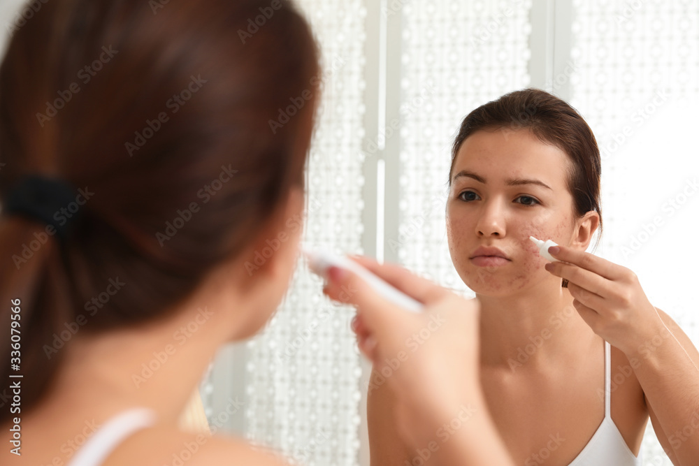Teen girl with acne problem applying cream near mirror in bathroom Teen girl with acne problem applying cream near mirror in bathroom