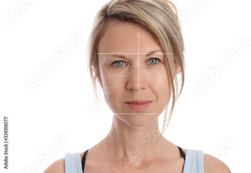 Scoliosis face asymmetry. Orthodontics and Posture Corection