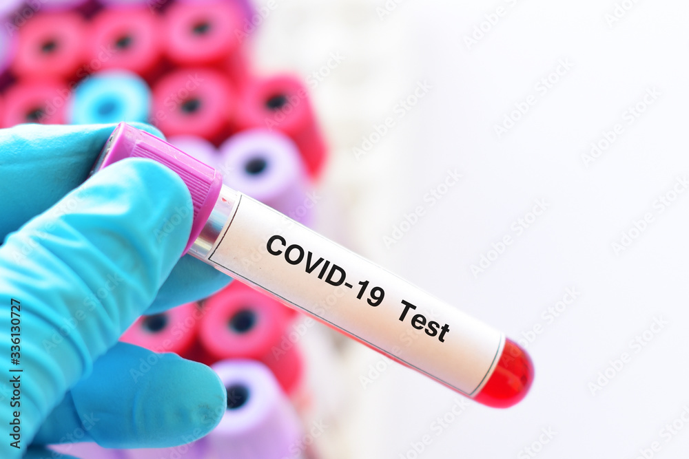 Obraz premium Test tube with blood sample for COVID-19 test