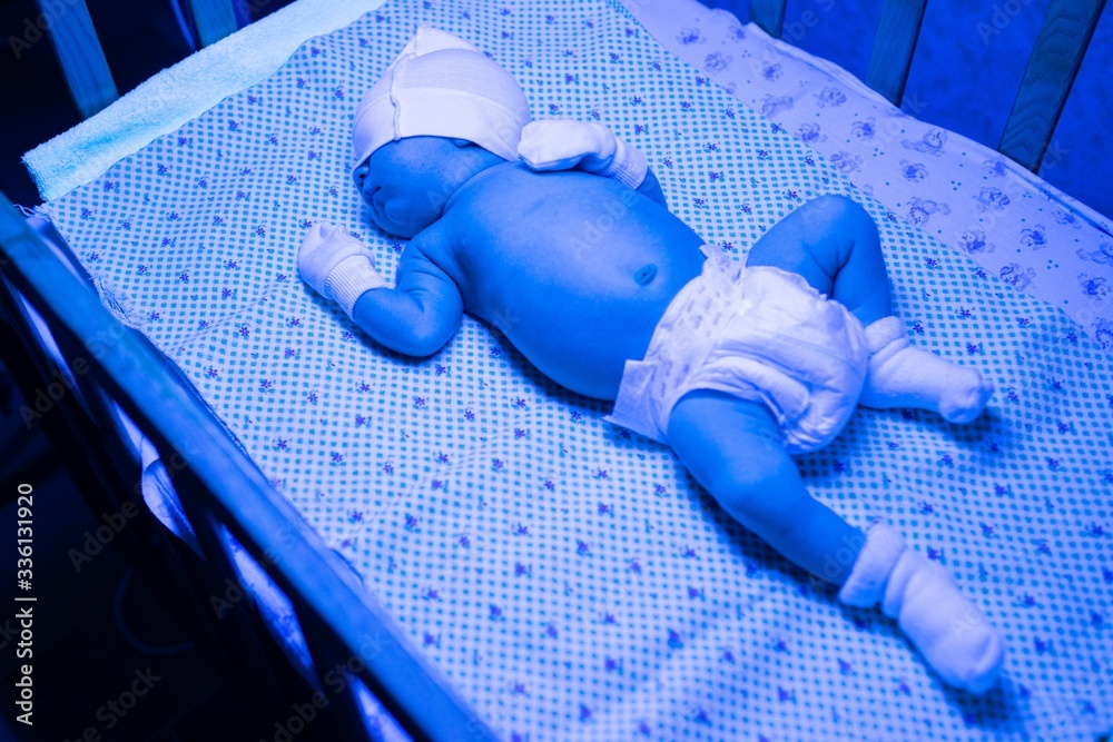 Newborn having a treatment for jaundice under ultraviolet light, Baby