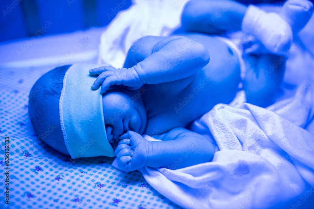 Foto de Newborn having a treatment for jaundice under ultraviolet light