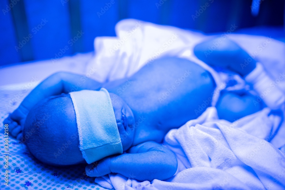 Newborn having a treatment for jaundice under ultraviolet light, Baby