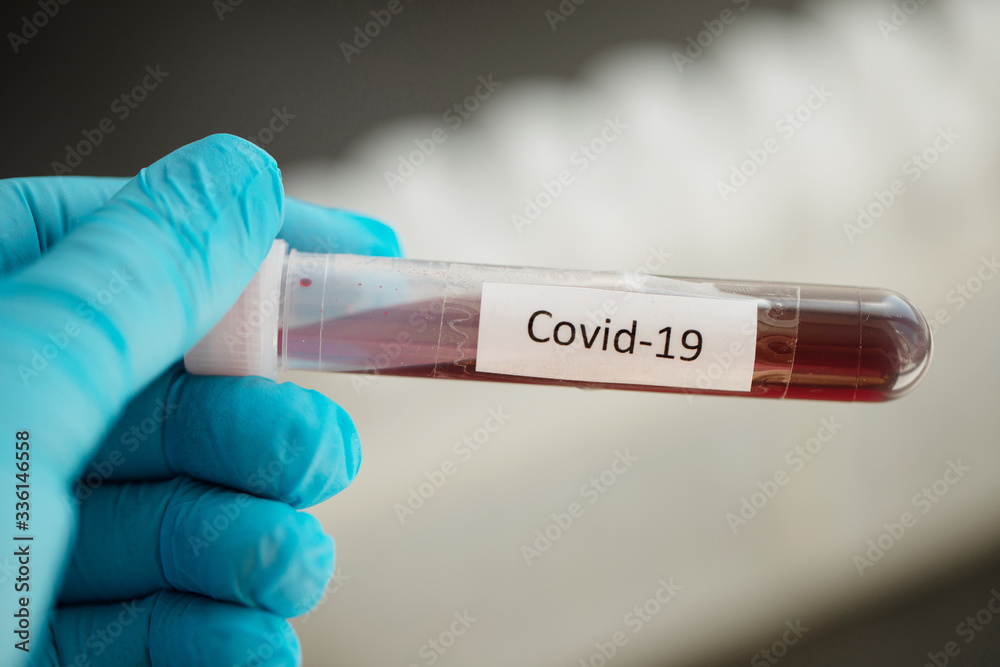 Fototapeta premium Test tube with blood sample for COVID-19 test, novel coronavirus 2019 found in Wuhan, China.