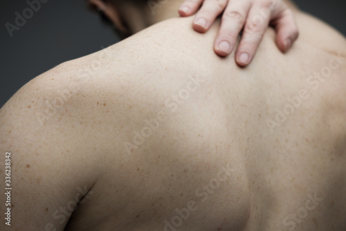 Woman with no face reaching her hand to her bare back and shoulders with pale skin and freckles