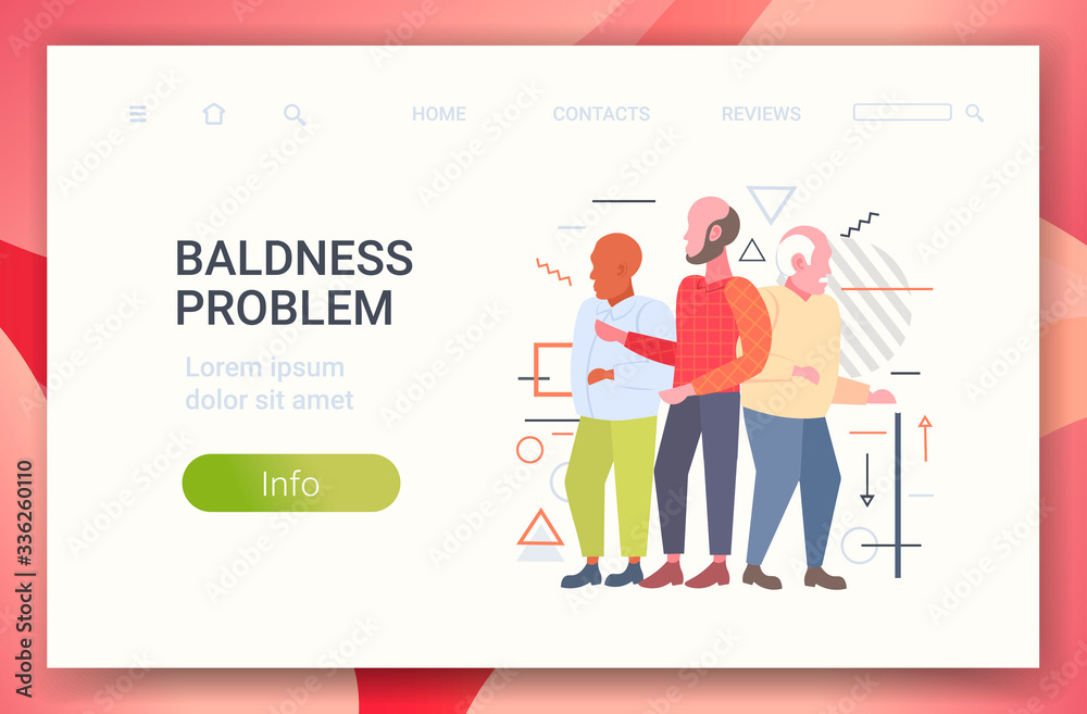 men with bald head standing together hair loss baldness problem concept horizontal copy space full length vector illustration