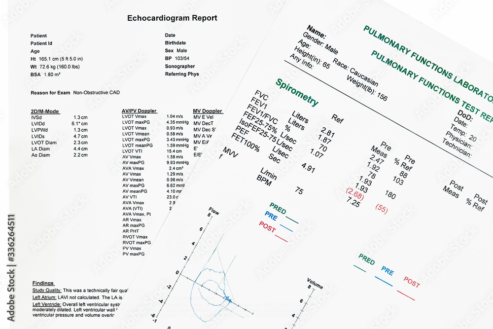 Close up of Pulmonary Functions Test and ECG Report Close up of Pulmonary Functions Test and ECG Report