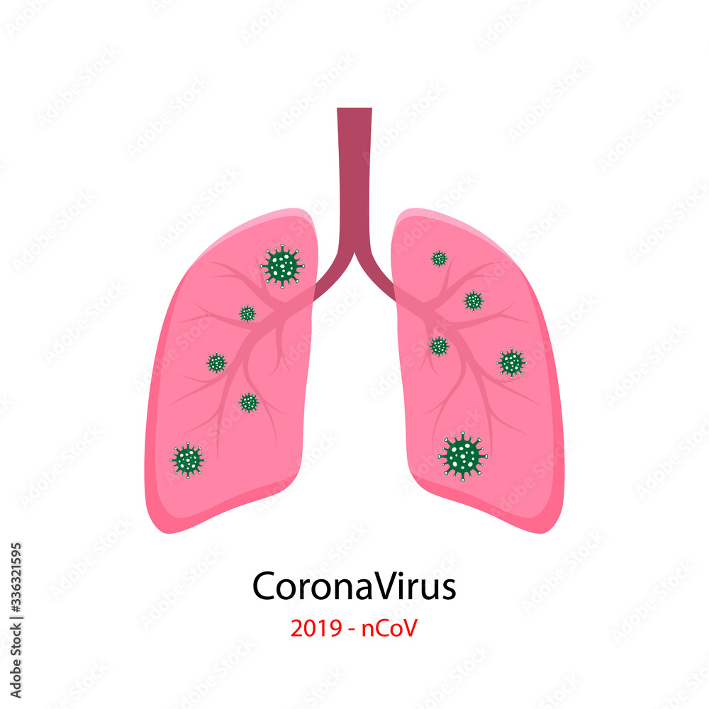 Human Lungs with Coronavirus 2019-nCoV Human Lungs with Coronavirus 2019-nCoV