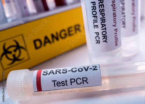 Vial pcr de SarsCov2 coronavirus, conceptual image photo