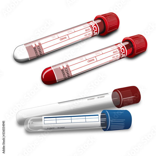 Blood Test Laboratory Vials