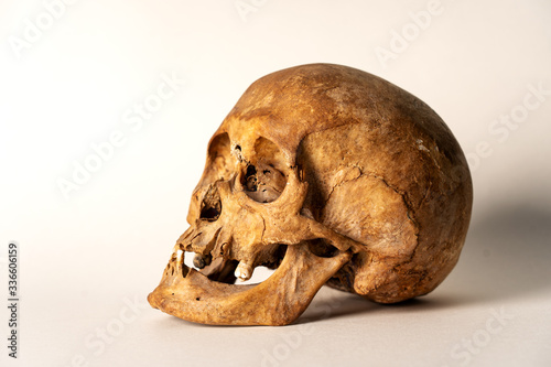 schädel,skull,anatomie, mensch, weiß, bones, kopf, zahn