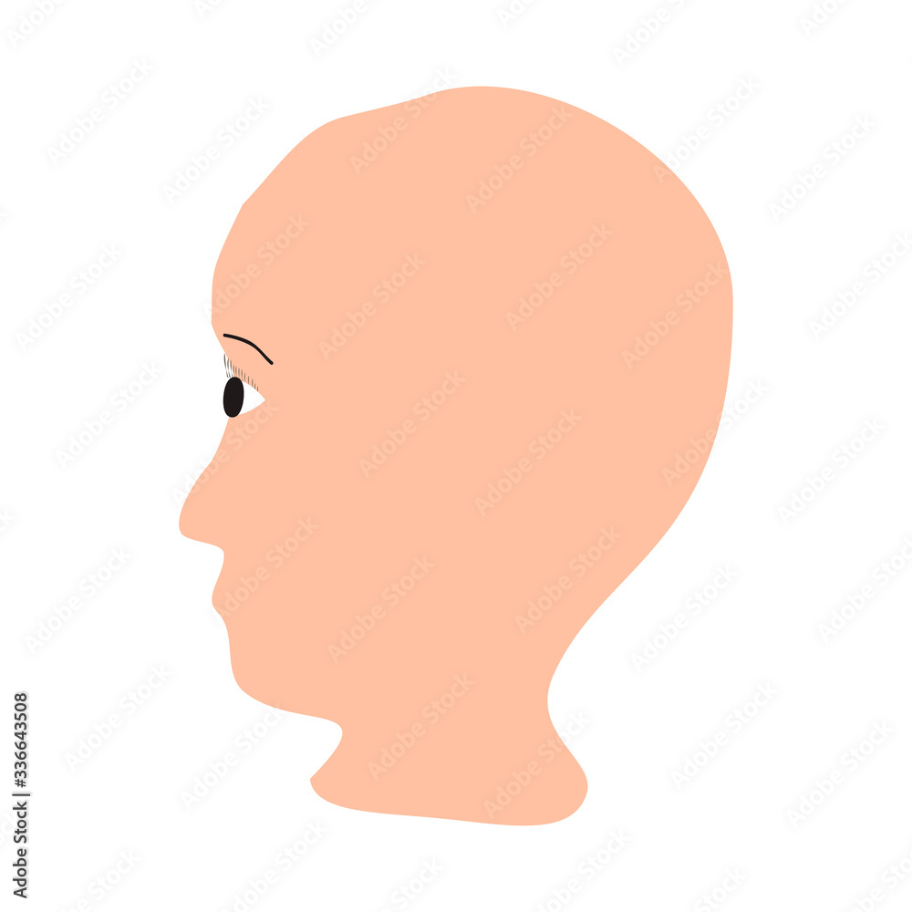 Alopecia hair. Baldness of hair on the head. Anagen Alopecia. Infographics. Vector illustration on isolated background. Alopecia hair. Baldness of hair on the head. Anagen Alopecia. Infographics. Vector illustration on isolated background.