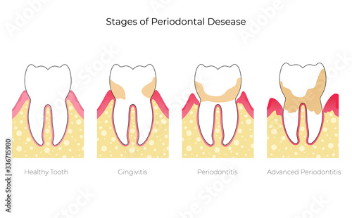 Vector isolated illustration of tooth 