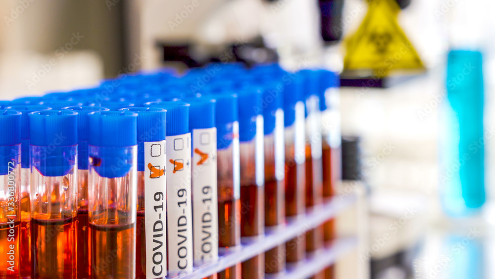 Three positive samples of covid-19 or coronavirus Three positive samples of covid-19 or coronavirus