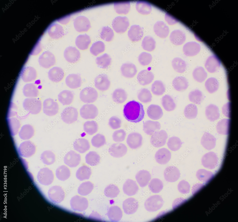 Red blood cells and white blood cells background. Red blood cells and white blood cells background.