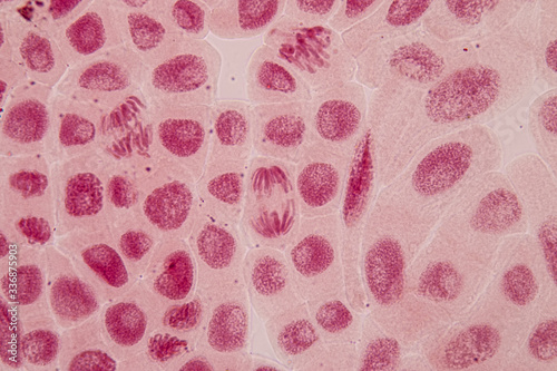 Foto Root tip of Onion and Mitosis cell in the Root tip of Onion under a microscope