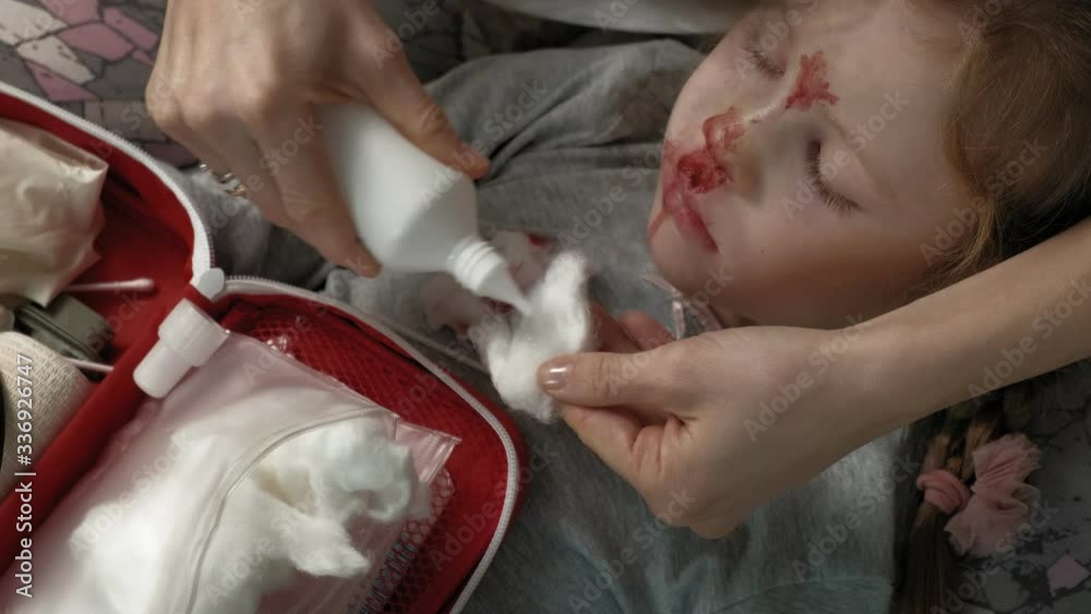 Mom provides first aid to a child with a bloody nose. Mom provides first aid to a child with a bloody nose.