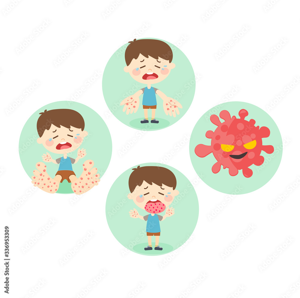 Hand Foot and Mouth Disease Vector