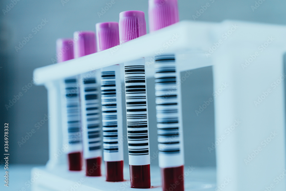 Blood test sample tubes in a rack for laboratory blood analysis. Science and Medical concept.