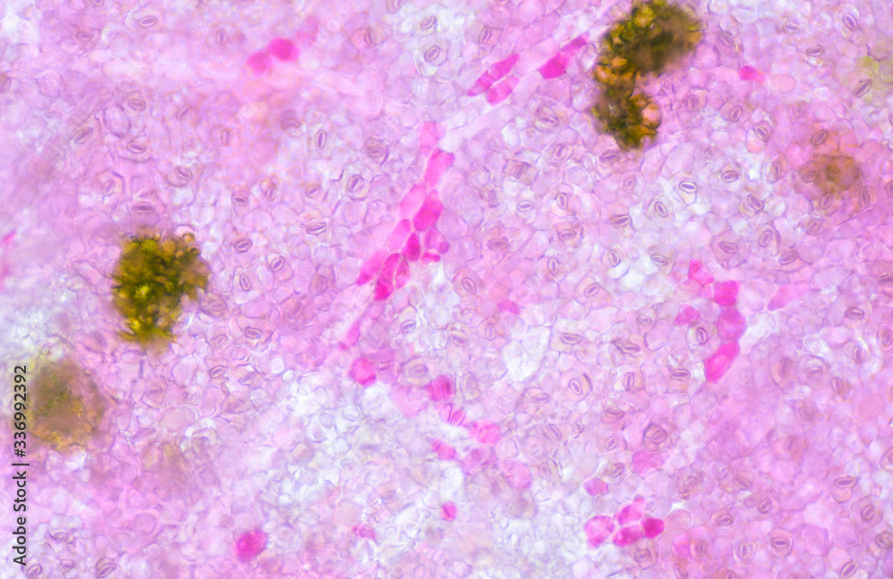 Blur texture of plants cells.