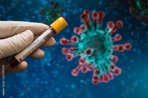 Close-up of a hand with white glove holding a sample of blood test tube which is positive for Covid-19 on blurred Coronavirus depiction background. Positive coronavirus test tube.