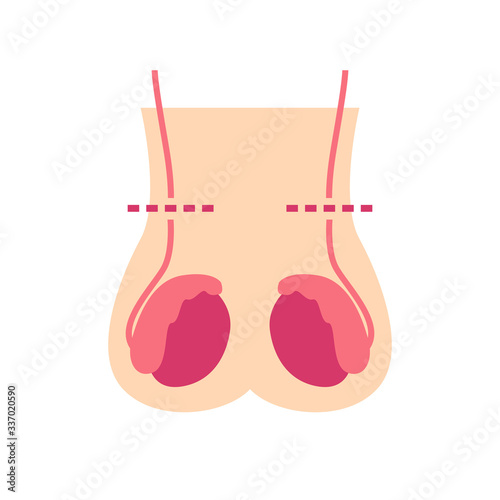 vasectomy flat icon, vector illustration