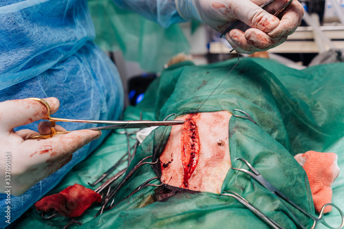 Detail Of The Surgery Of A Dog. photo