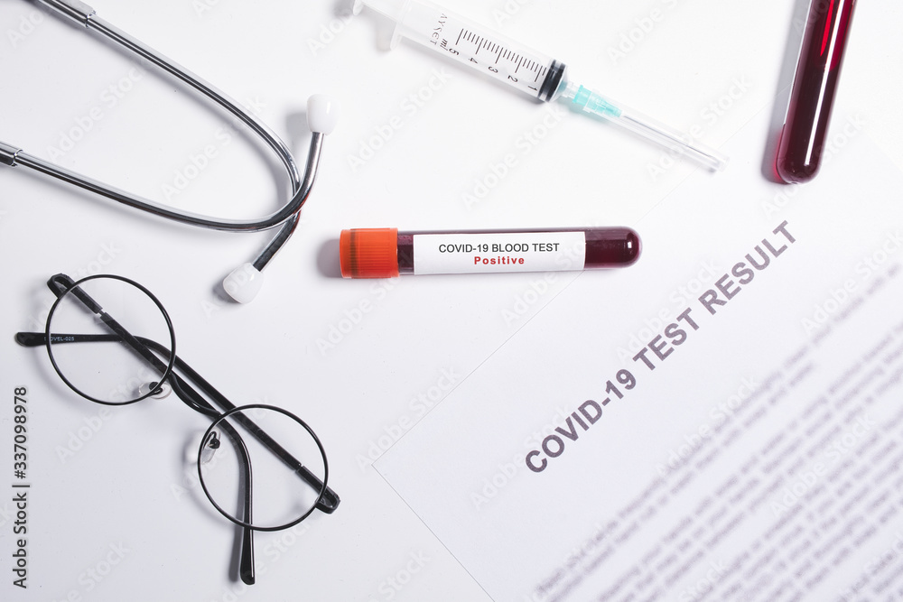 Coronavirus positive blood test result, rapid blood test for Coronavirus or Covid-19 pandemic. Coronavirus positive blood test result, rapid blood test for Coronavirus or Covid-19 pandemic.