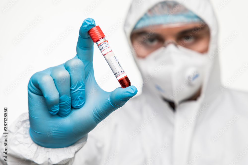 COVID-19 test and laboratory sample of blood testing for diagnosis new Corona virus infection. Disease 2019 from Wuhan. Pandemic infectious concept COVID-19 test and laboratory sample of blood testing for diagnosis new Corona virus infection. Disease 2019 from Wuhan. Pandemic infectious concept