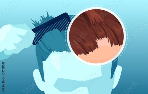 Vector of a man combing and loosing hair