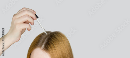 A glass pipette with a hair growth agent is applied to the parting of the hair, red hair. Hair care. Light background, free space for text.