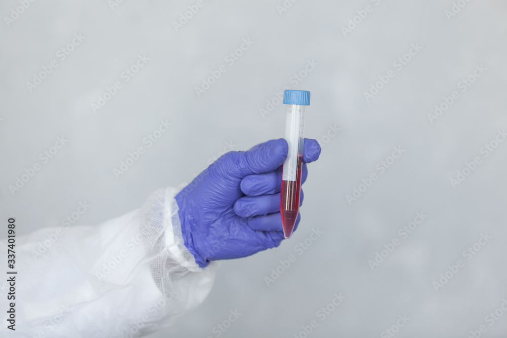 Doctor hand in glove is holding blood sample fot testing it on COVID, COVID-19, coronavirus to stop pandemic and epidemic of the virus