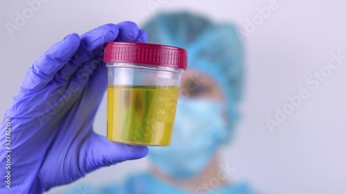 Female doctor shows container with urine tests. 4k
