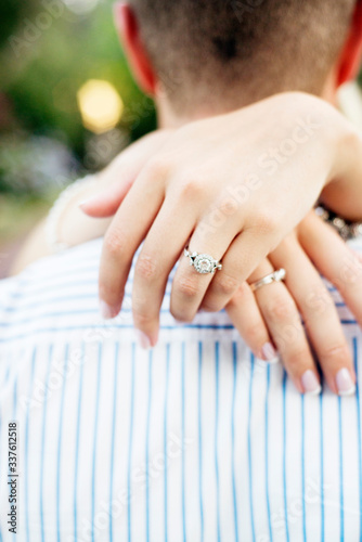 Caucasian engaged Woman s hand behind mans head with an engagement ring. 