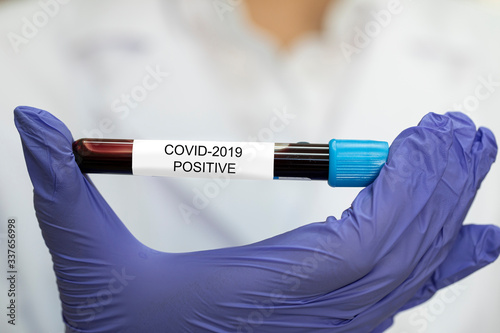 Positive COVID-19 test laboratory sample of blood testing for diagnosis coronavirus infection (novel coronavirus disease) in doctor's hand. Widespreading testing, confirmed cases of infection photo