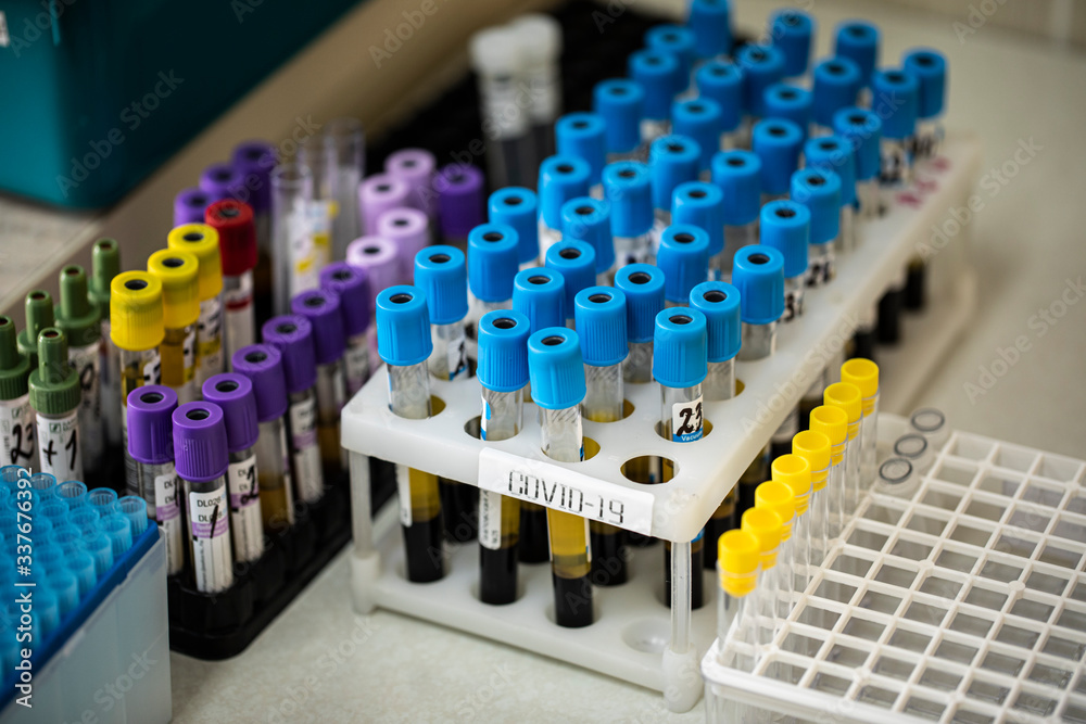 Fototapeta premium Holder with lab tubes of biological samples contaminated by coronavirus