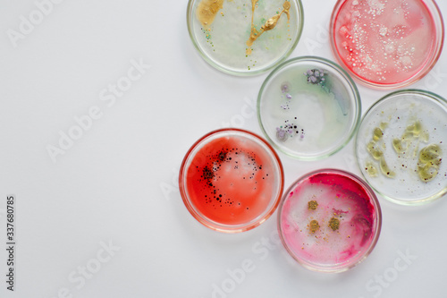 Viruses and bacteria in a Petri dish, studying the growth of bacteria on different samples in the laboratory. photo
