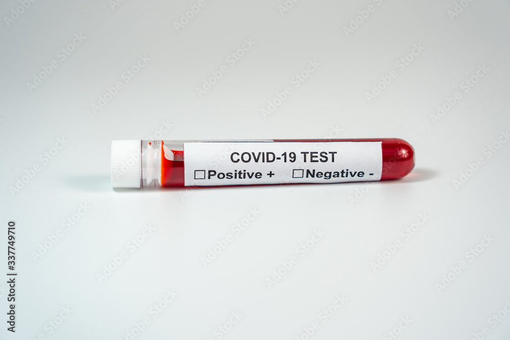 Blood test tube of Covid-19 pandemic on white background Blood test tube of Covid-19 pandemic on white background