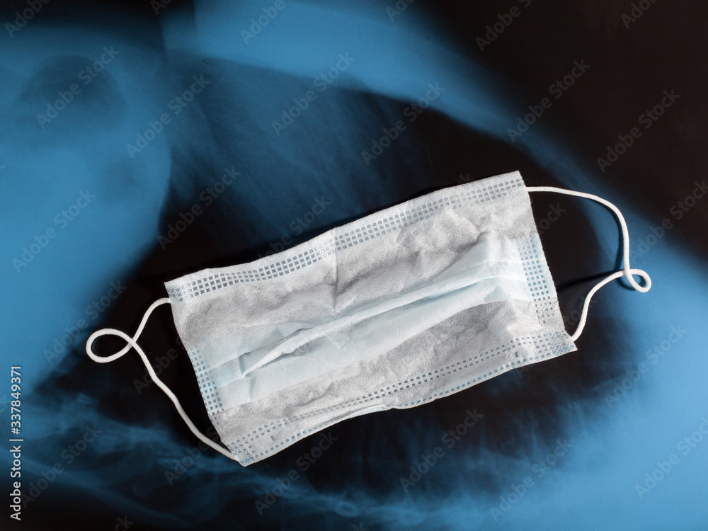 Medical ear-loop mask on blue black X-ray image background