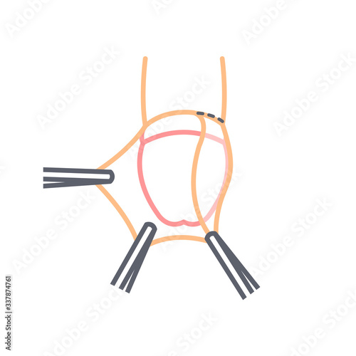 circumcision line icon, vector illustration