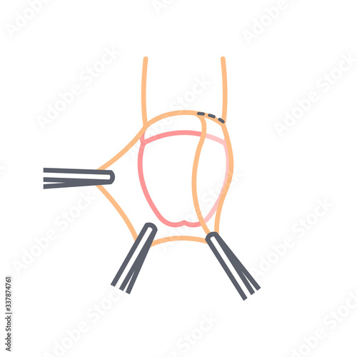 circumcision line icon, vector illustration photo