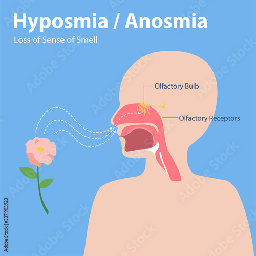 Hyposmia Anosmia, Loss of Sense of Smell Info graphic elements the signs of corona virus Symptoms , Health care concept. photo