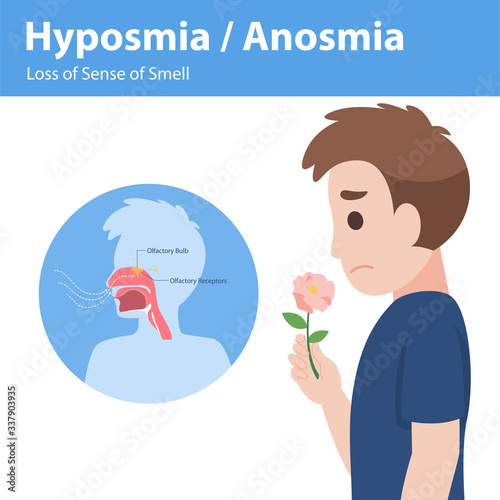 Hyposmia Anosmia, Loss of Sense of Smell Info graphic elements the signs of corona virus Symptoms , Health care concept