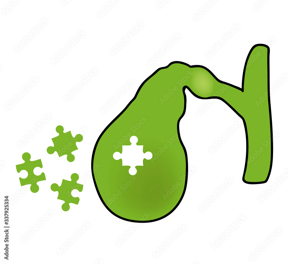 gall bladder. gall bladder problems. collect puzzle. vector illustration. gall bladder. gall bladder problems. collect puzzle. vector illustration.