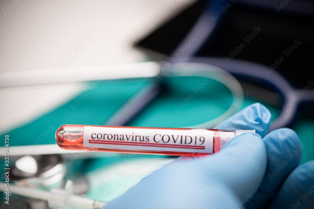 Doctor hands holding COVID 19 Coronavirus test blood. Doctor hands holding COVID 19 Coronavirus test blood.