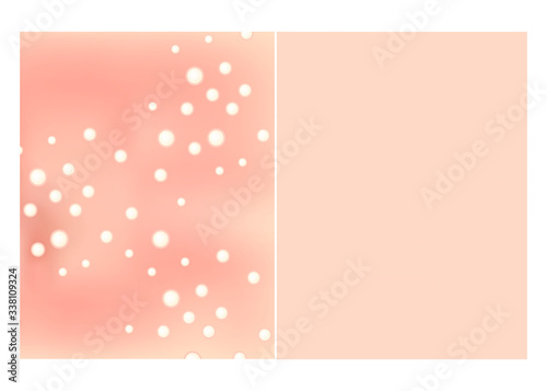 Texture, inflamed pimples and acne. Before After acne. Skin background. Infographics. Vector illustration on isolated background