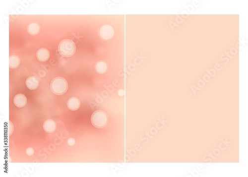 Texture, inflamed pimples and acne. Before After acne. Skin background. Infographics. Vector illustration on isolated background