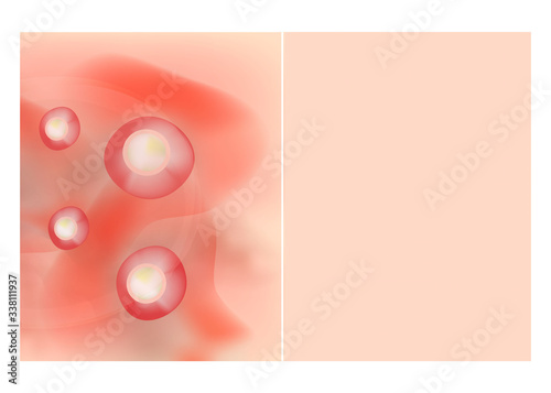 Texture, inflamed pimples and acne. Before After acne cysts. Skin background. Infographics. Vector illustration on isolated background.