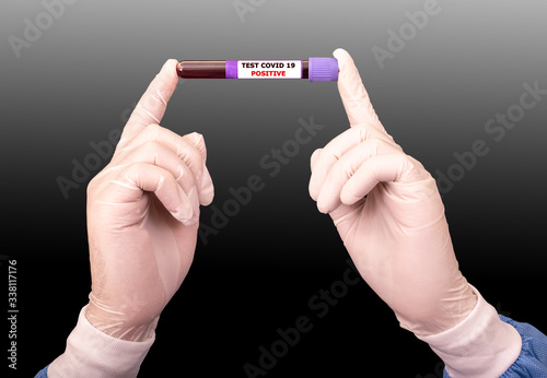 Doctor's hands hold a test tube containing a blood sample, test tube with blood for Covid-19 analyzing. Laboratory positive coronavirus testing patient’s blood