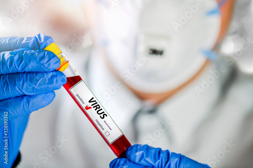 Coronavirus blood sample in blue glove hand with positive blood dangrous virus. photo