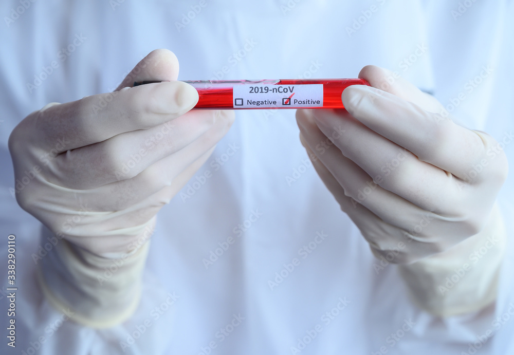 Close up of scientist doctor hand holding a sample test tube with blood for 2019-nCoV analyzing. Conceptual of laboratory testing for the respiratory coronavirus disease 2019 (COVID-19). Close up of scientist doctor hand holding a sample test tube with blood for 2019-nCoV analyzing. Conceptual of laboratory testing for the respiratory coronavirus disease 2019 (COVID-19).
